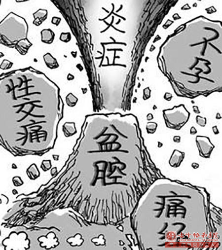 妇科炎症