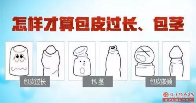 马鞍山怎么检查包皮过长？知道6点就够了